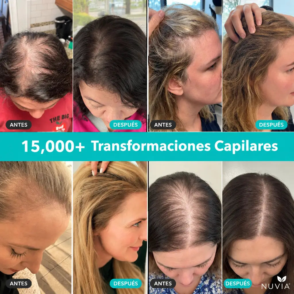 NUVIA PDRN Sérum Capilar Cepillo con Microagujas