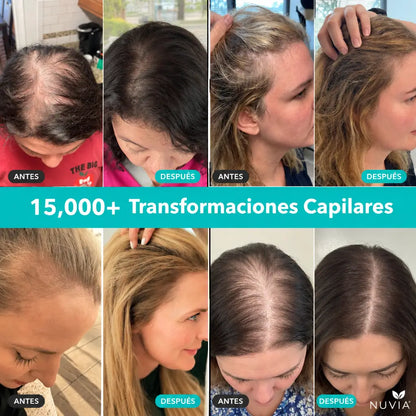 NUVIA PDRN Sérum Capilar Cepillo con Microagujas